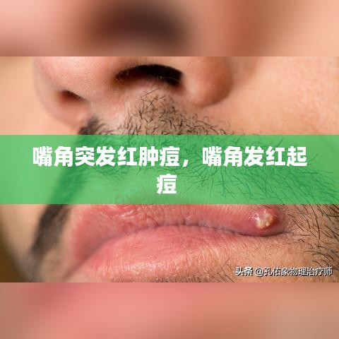 嘴角突發紅腫痘，嘴角發紅起痘 